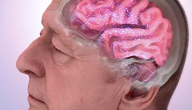 Glyphosate may be linked to neurodegenerative diseases