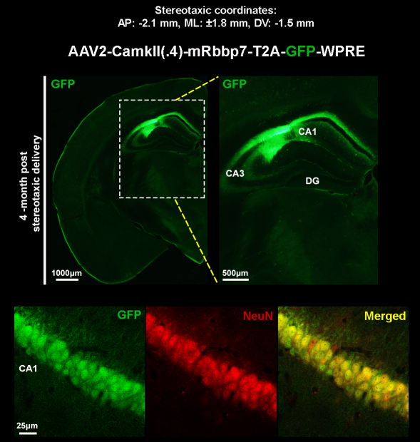 AAV Rbbp7 Expression